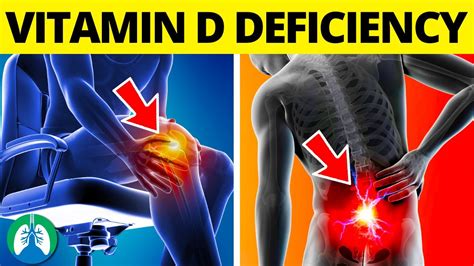 low vitamin d icd 10